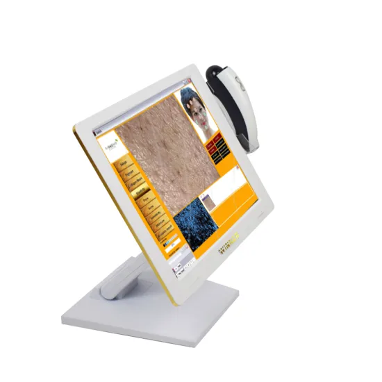 Hot Selling Acne/Moisture/Pore Face Scanner Skin Diagnostic Analyzer