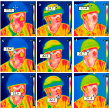 810nm psychiatric disoders cure laser therapy helmet