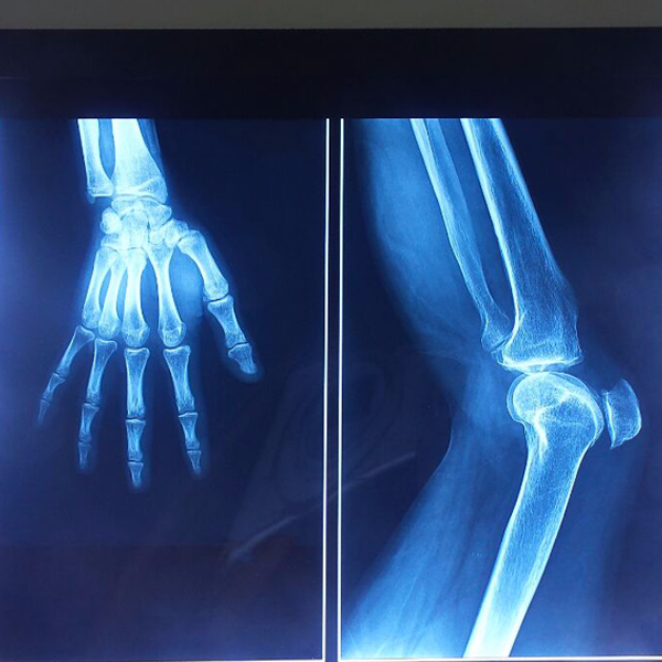 medical film 6-3