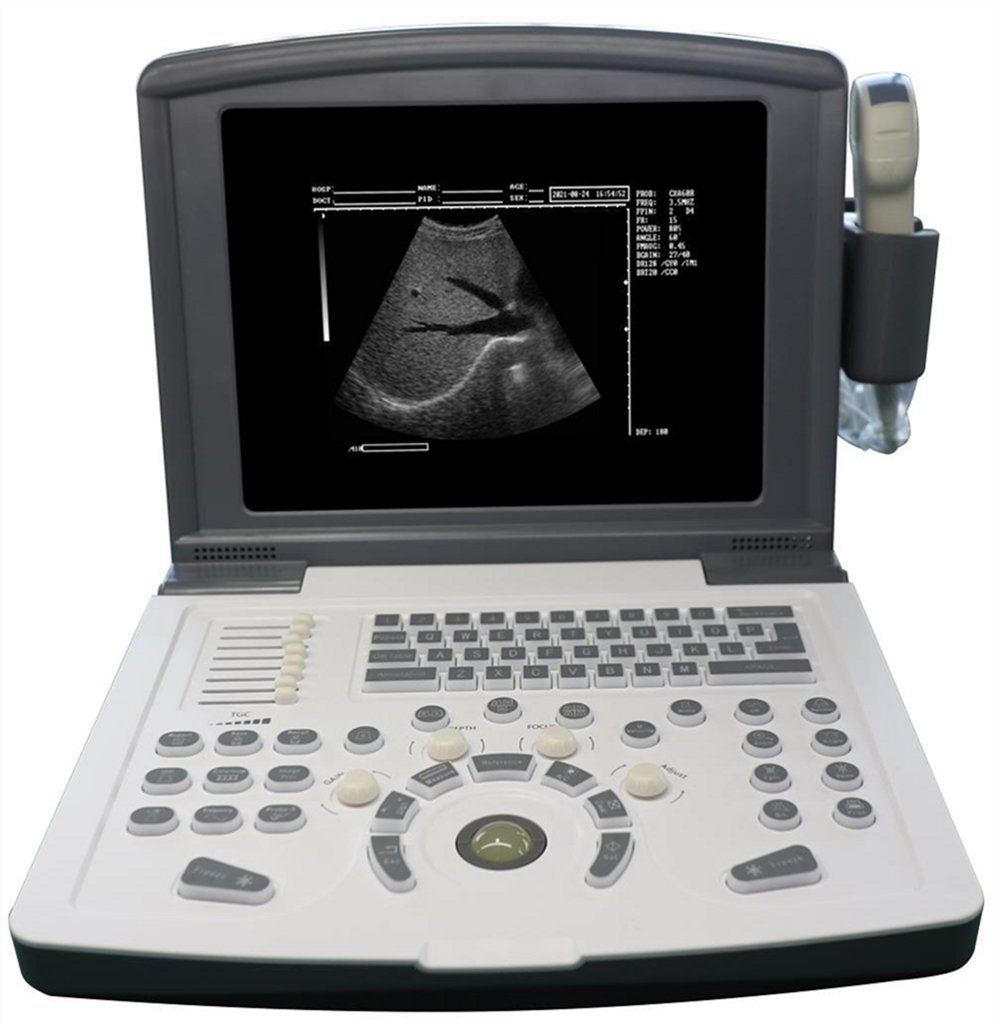 Scanner b-ultrasound portable pour cardiovasculaire