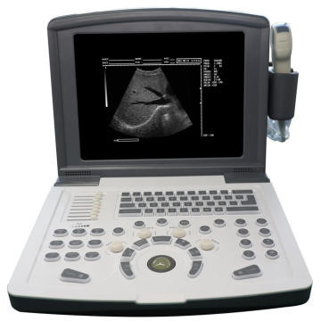 Escáner b-ultrasonido portátil para cardiovascular