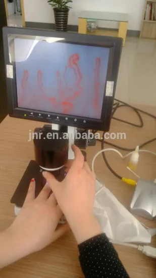 medical microcirculation test machine