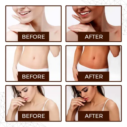 Dark Deep Self-Tanning Mousse: Premium Sun Tanning Foam and Tanning Spray for a Natural Tan