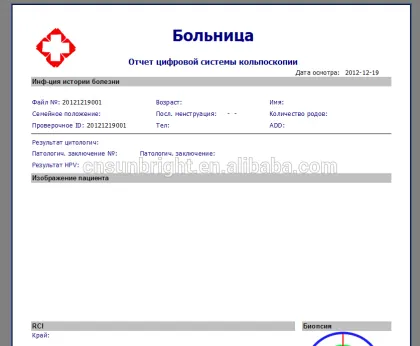 hot colposcopy equipment with trolley on sales promotion