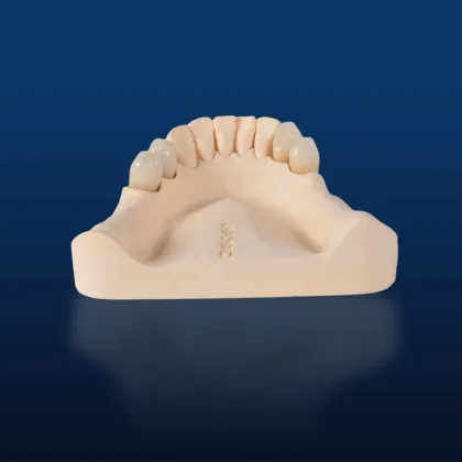 Zirconia Veneered Whitening Device
