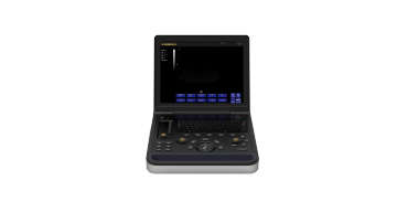 Male liver cyst uitrasound diagnostic instrument