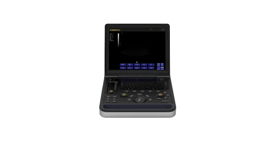 Male liver cyst uitrasound diagnostic instrument