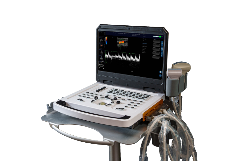 Beste Laptop -Farbdoppler -Ultraschalldiagnosemaschine