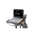 Best laptop color Doppler ultrasound diagnostic machine