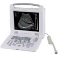 Draagbare Laptop Ultrasound Scanner Ultrasound Machine Prijs