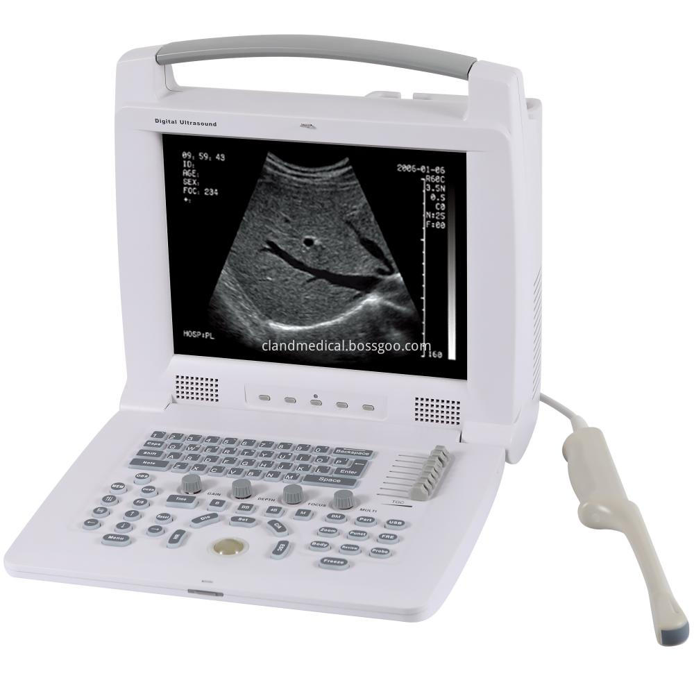 Pl 3018i Full Digital Portable Ultrasound Scanner 11