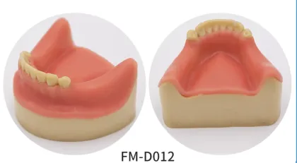 Dental Study Model Clinic Demonstration: Implant Model with Restoration and Implant Bridge