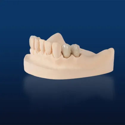 Zirconia Veneered Whitening Device