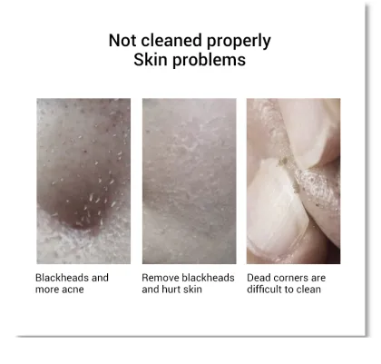 2020 blackhead remover set blackhead remover