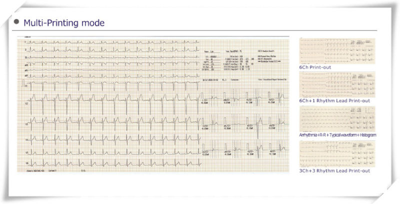 Digital 12-Lead ECG Machine with Color Display (PRO-ECG12N)