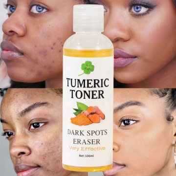 Natural Organic Facial Skin Care: Removes Dark Spots, Moisturizes, Nourishes, Repairs Acne with Turmeric Face Toner