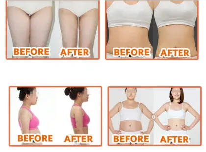 The Red Slimming Ampoules/ Weight Loss Lipolysis Solution Red Ampoule 10ml Slimming Body Weight Loss