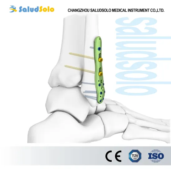 Distal Fibular Locking Plate