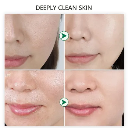 Organic Enzyme Facial Cleanser for Clear Skin Care