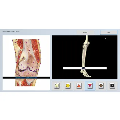 oberon non linear aura diagnostic device