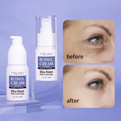 Eye Bag Removal Anti Aging Retinol Eye Cream