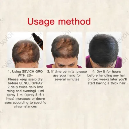Sevich Hair Growth Spray 30ml Hair Loss Product Hair Regrowth Spray Anti Hair Loss Treatment Thicken Thin Hair TSLM1