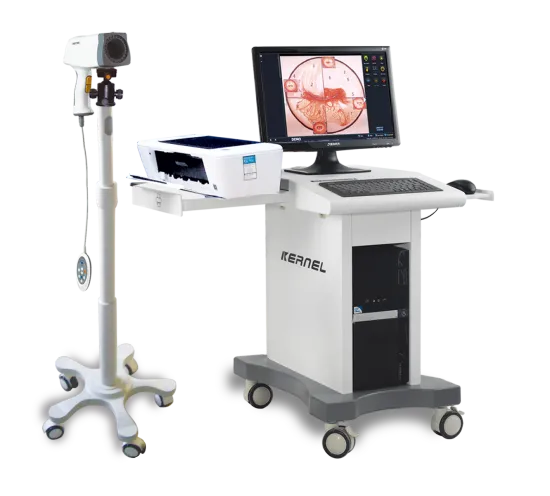 Digital Colposcopy: Enhancing Gynecological Examinations in Hospital Settings