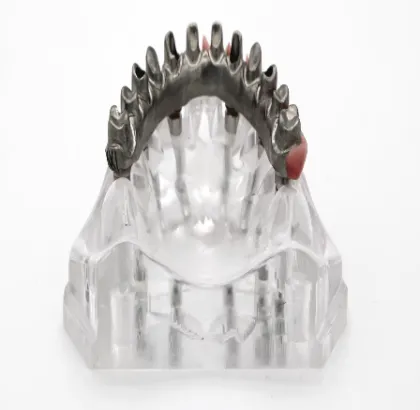 Dental Implant Model Overdenture Restoration Dental Teeth Model Factory Shop On Sale High Quality