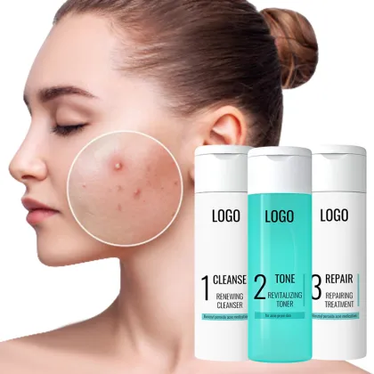 Vegan Anti-Acne Facial Care Set: Oil Control Cleanser, Moisturizer, and Toner