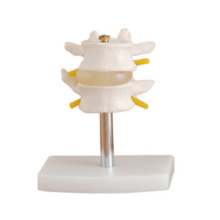 Combinación lumbar normal (dos segmentos)