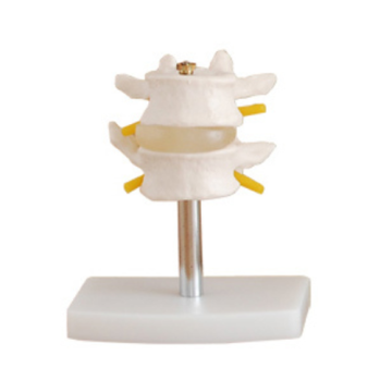 Normal lumbar combination (two segments)