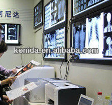 made in china imager leser film imager made in china imager