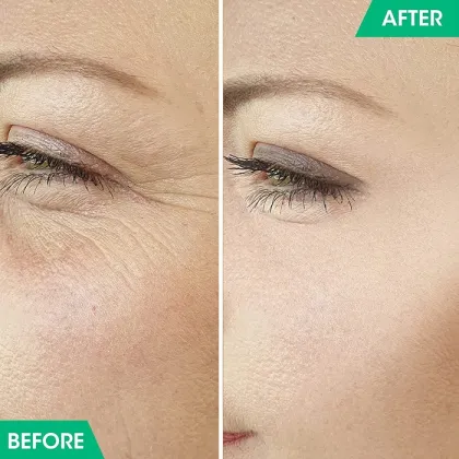 Private Label Anti-wrinkle women face cream