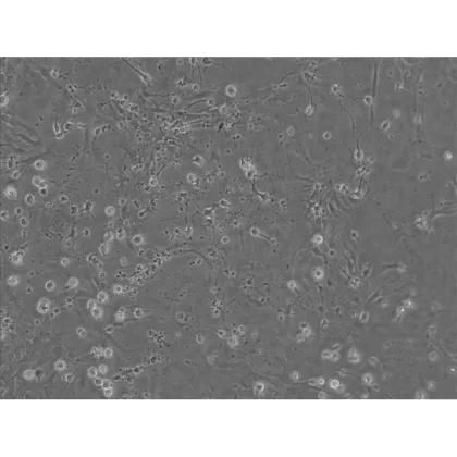 FL-100T Inverted Fluorescence Microscope for Laboratory Research
