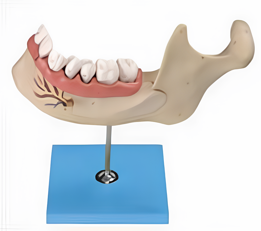 Lower Jaw of 18-year-old