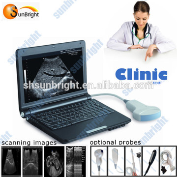 b ultrasound diagnostic system |China b ultrasound scanner