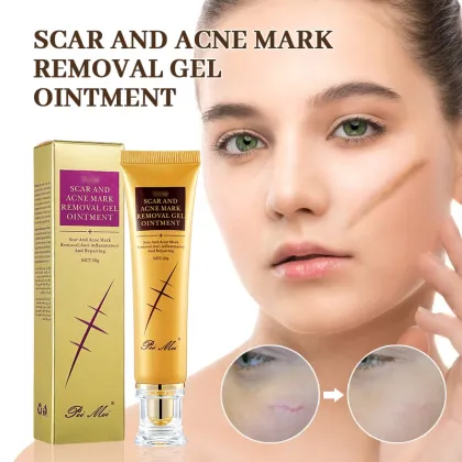 Fast Acne Cream: Anti-Spots, Scar & Stretch Marks Treatment