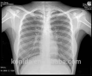 film scanner medical equipments camera xray films
