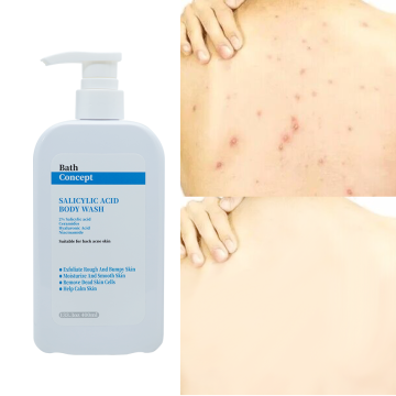 OEM Private Label Salicylic Acid Body Wash for Acne-Prone Skin