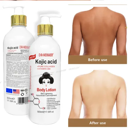 Kojic Acid Body Lotion for Moisturizing and Beauty