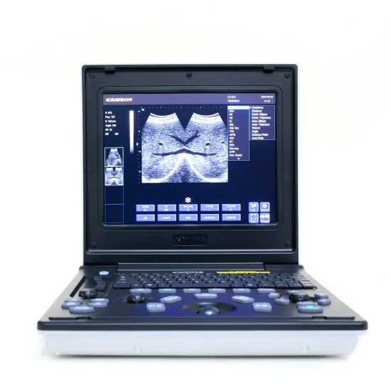 Children hepatitis ultrasound diagnostic instrument