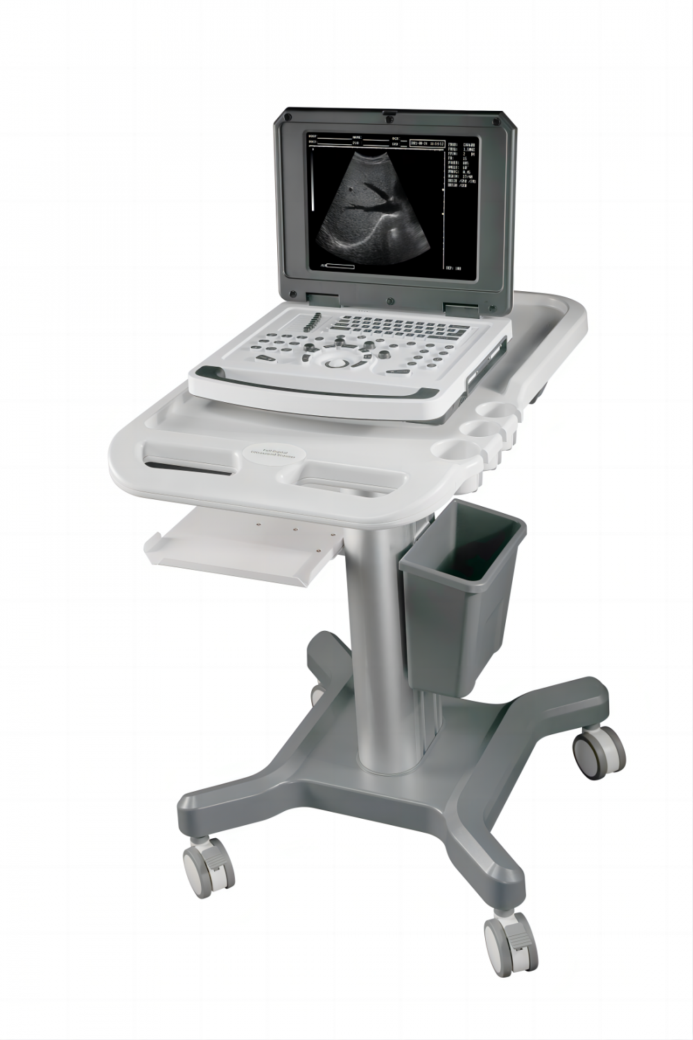 Notebook Machine de scanner à ultrasons noir et blanc en médecine
