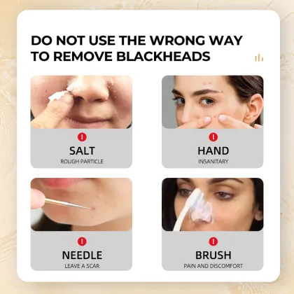 Dead Sea Mud Mask - Blackhead & Acne Removal, Pore Shrinker, Abyssal Mud Facial Mask