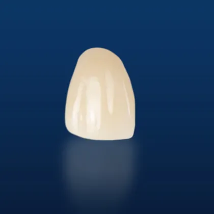 Customized Dental Implant Porcelain
