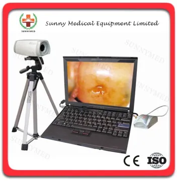 SY-F003 Portable electronic digital colposcopy