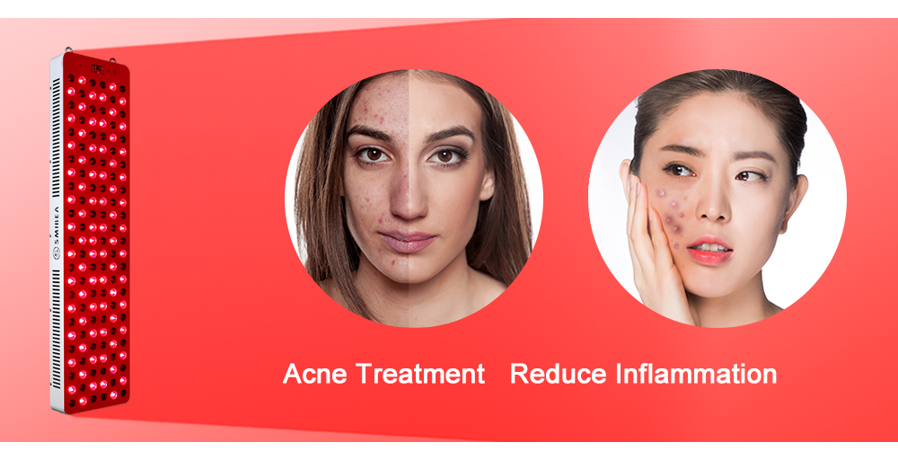 Best Professional Facial Light Therapy