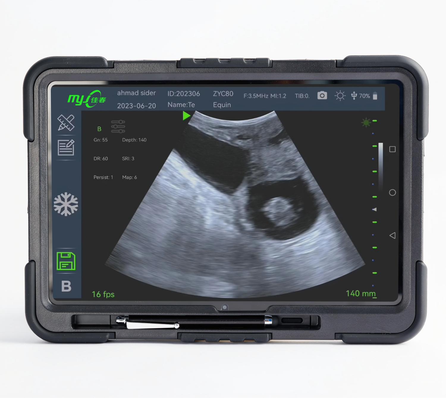 ultrasound machine veterinary use