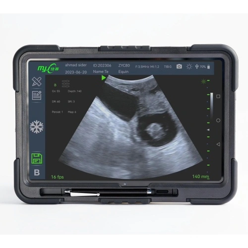 Fast Scan C Ultrasound Device for Veterinary Use for Sale, Offer Fast ...