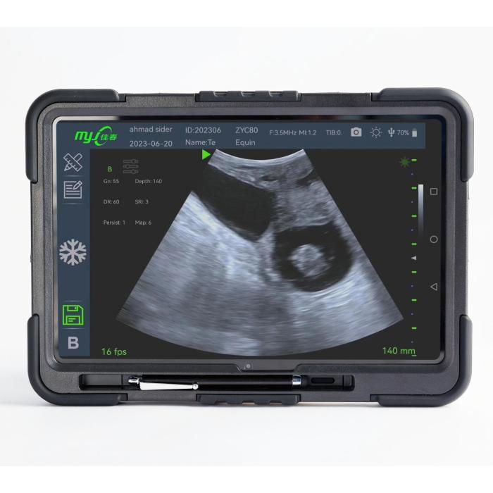 Fast Scan C ultrasound machine for veterinary