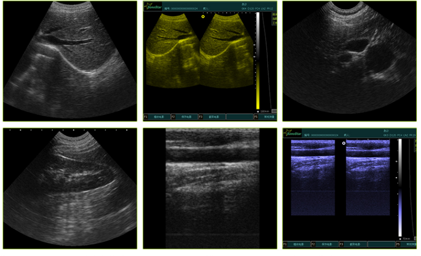 Portable Ultrasounder For Vet